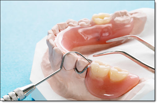Denture Restorations