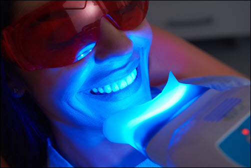 Whitening